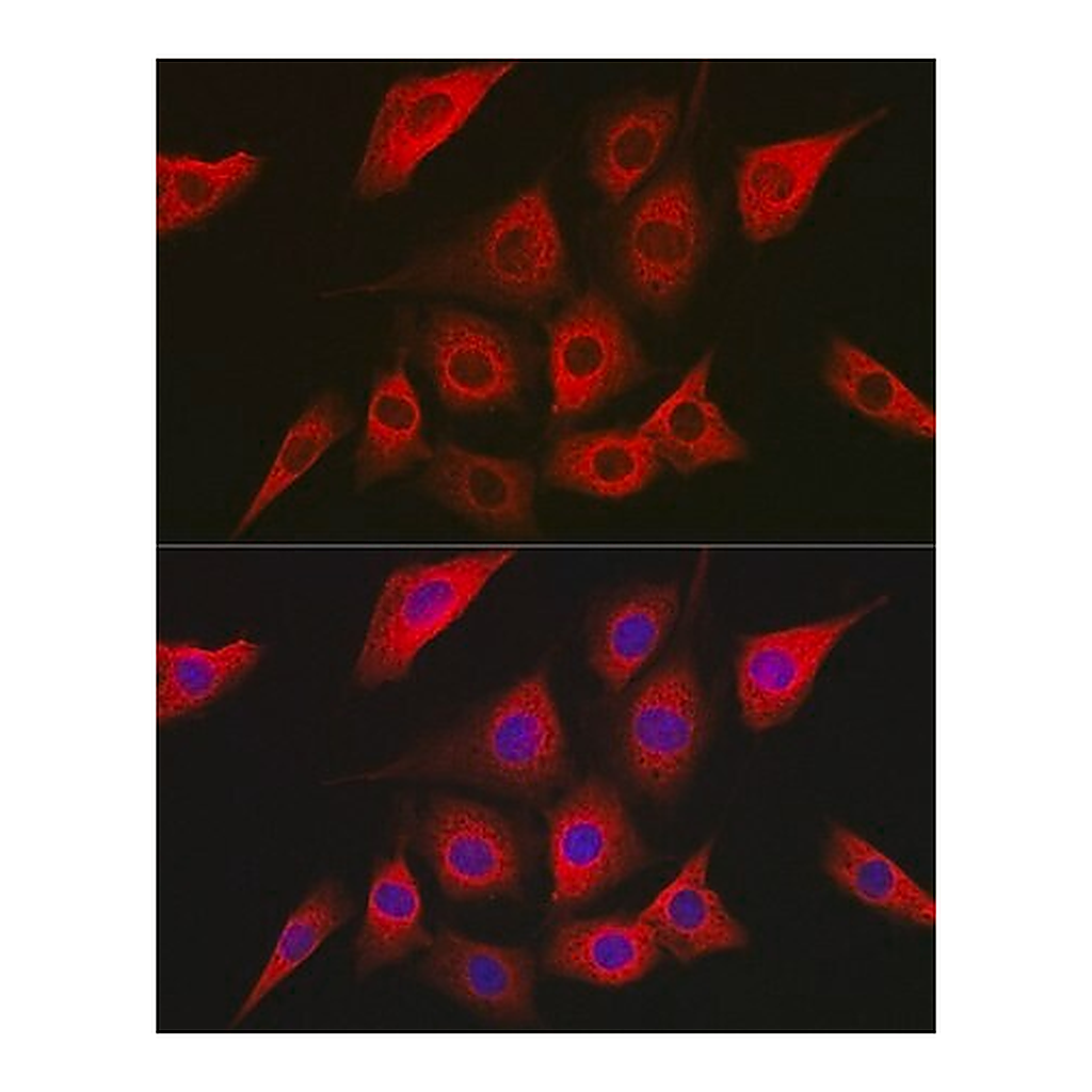 Merck Anti- AMPKalpha2 antibody produced in rabbit