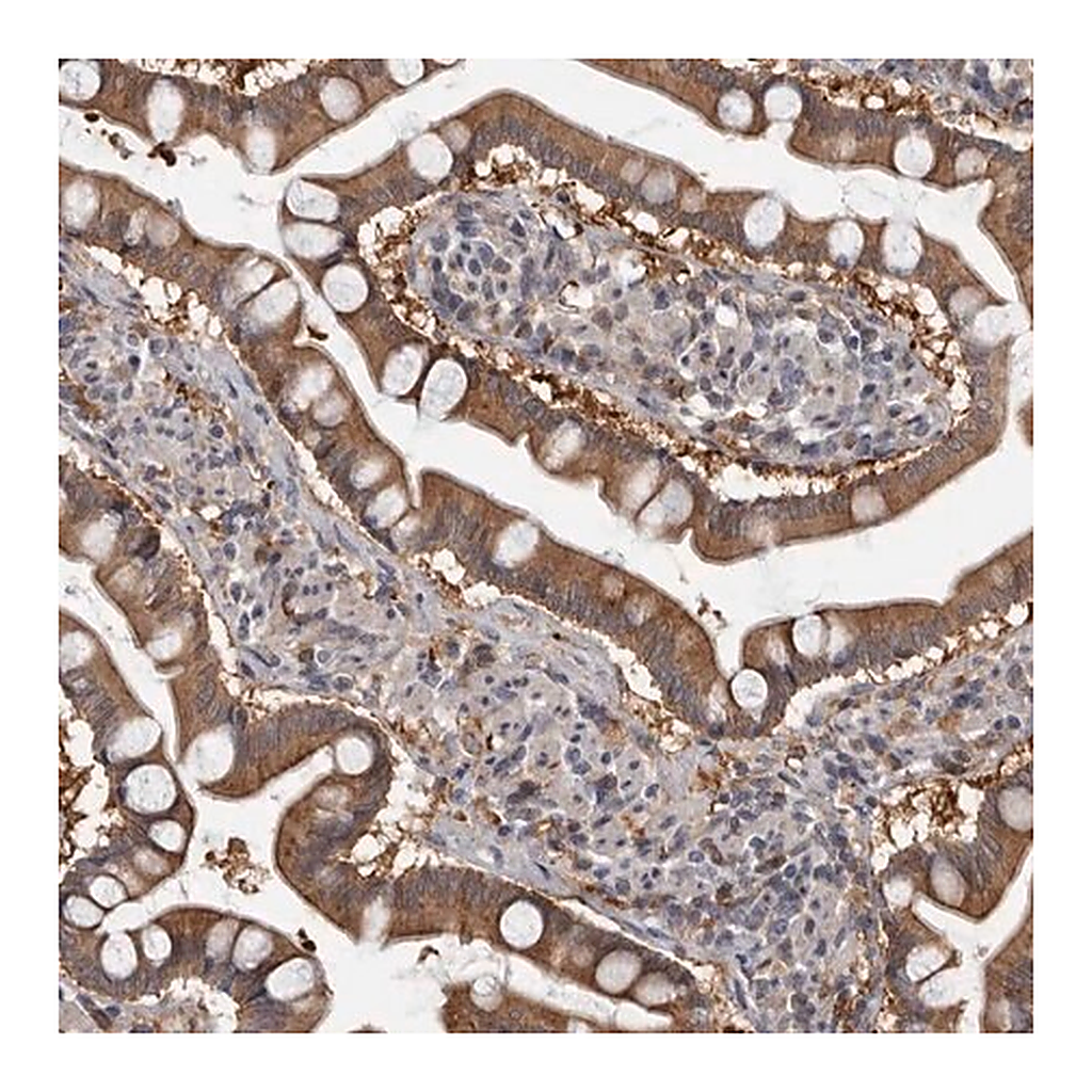 Merck Anti-FGFR4 antibody produced in rabbit