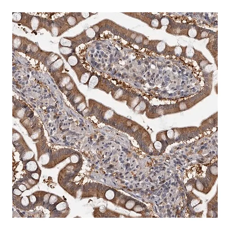 Merck Anti-FGFR4 antibody produced in rabbit