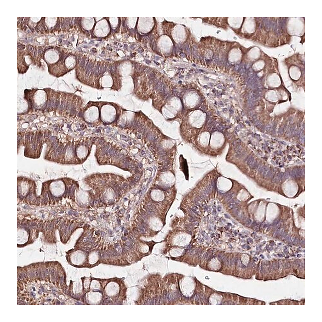 Merck Anti-ATE1 antibody produced in rabbit