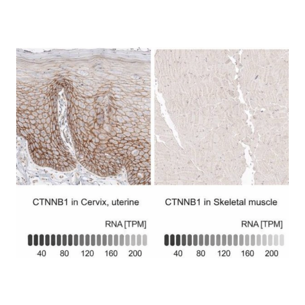 Merck Anti-CTNNB1 antibody produced in rabbit