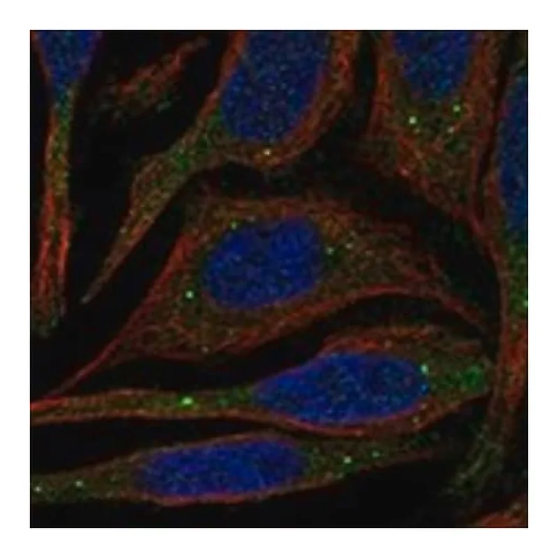 Merck Anti-PATL1 antibody produced in rabbit