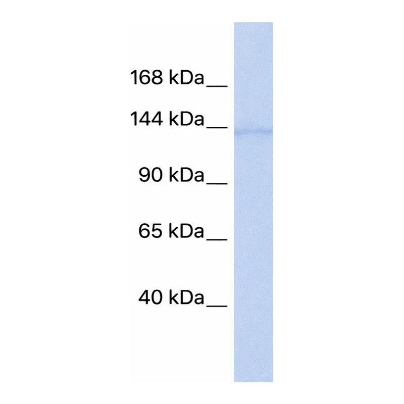 Merck Anti-ERCC5 antibody produced in rabbit