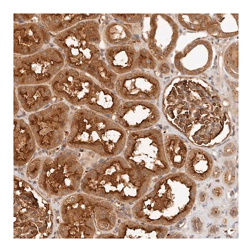 Merck Anti-FREM2 antibody produced in rabbit