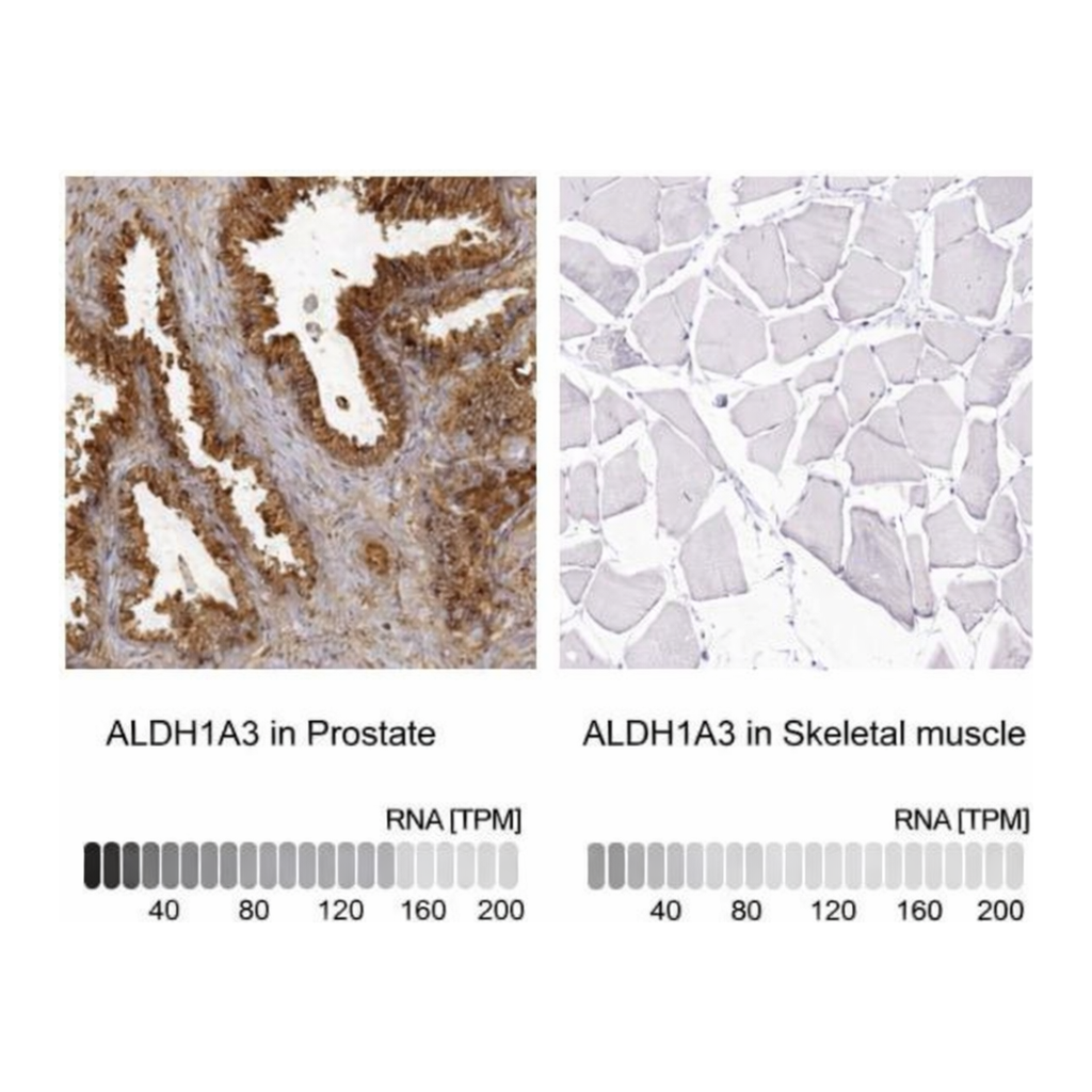 Merck Anti-ALDH1A3 antibody produced in rabbit