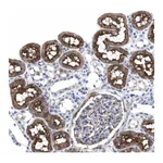 Atlas Antibodies Anti-ANKRD40 Antibody