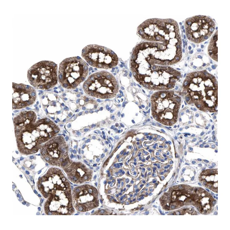 Atlas Antibodies Anti-ANKRD40 Antibody