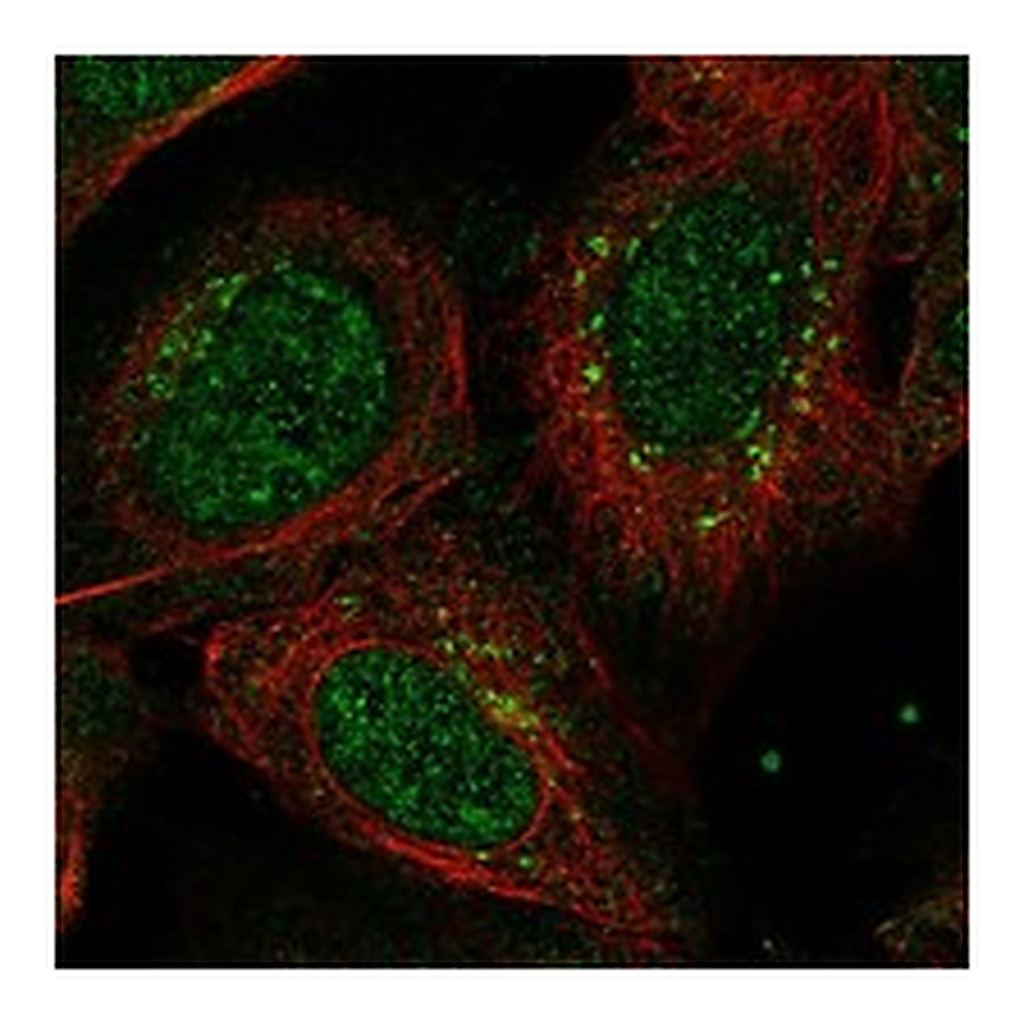Atlas Antibodies Anti-ANKRD40 Antibody