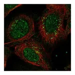 Atlas Antibodies Anti-ANKRD40 Antibody