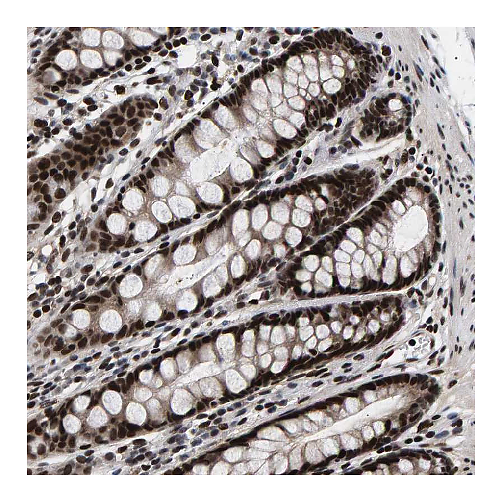 Atlas Antibodies Anti-ANKRD40 Antibody