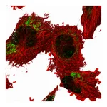 Atlas Antibodies Anti-ANKRD44 Antibody