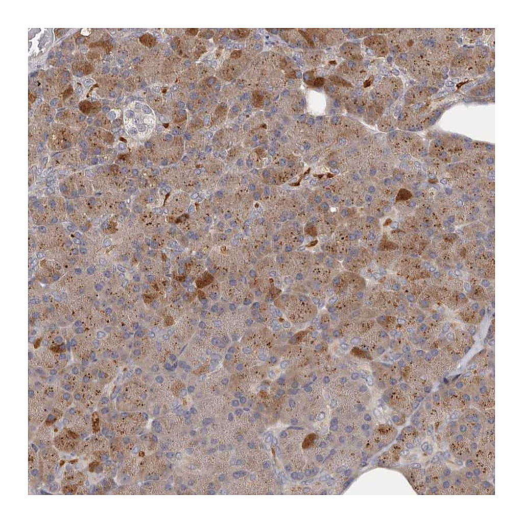 Atlas Antibodies Anti-ANKRD44 Antibody