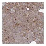 Atlas Antibodies Anti-ANKRD44 Antibody