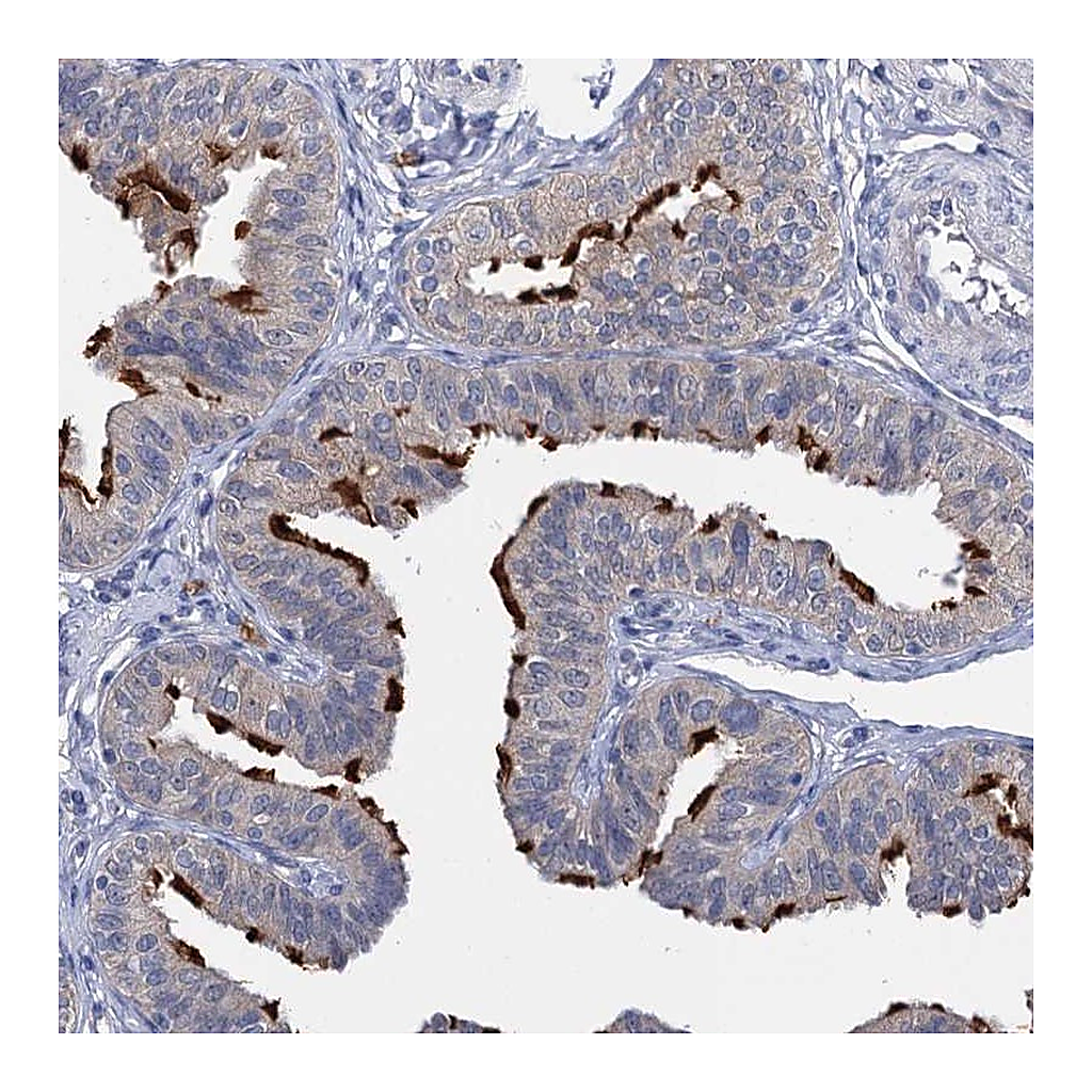 Atlas Antibodies Anti-ANKRD42 Antibody