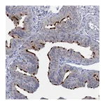 Atlas Antibodies Anti-ANKRD42 Antibody