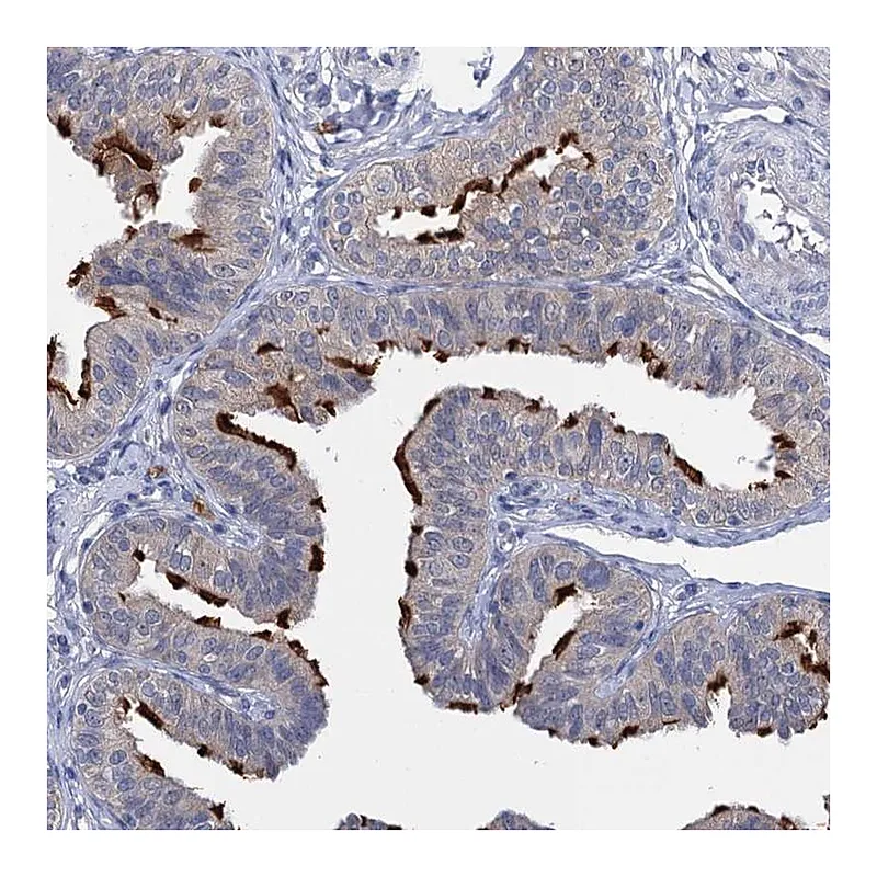 Atlas Antibodies Anti-ANKRD42 Antibody