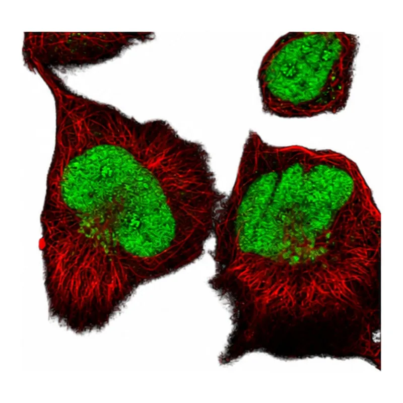 Atlas Antibodies Anti-ANKRD49 Antibody