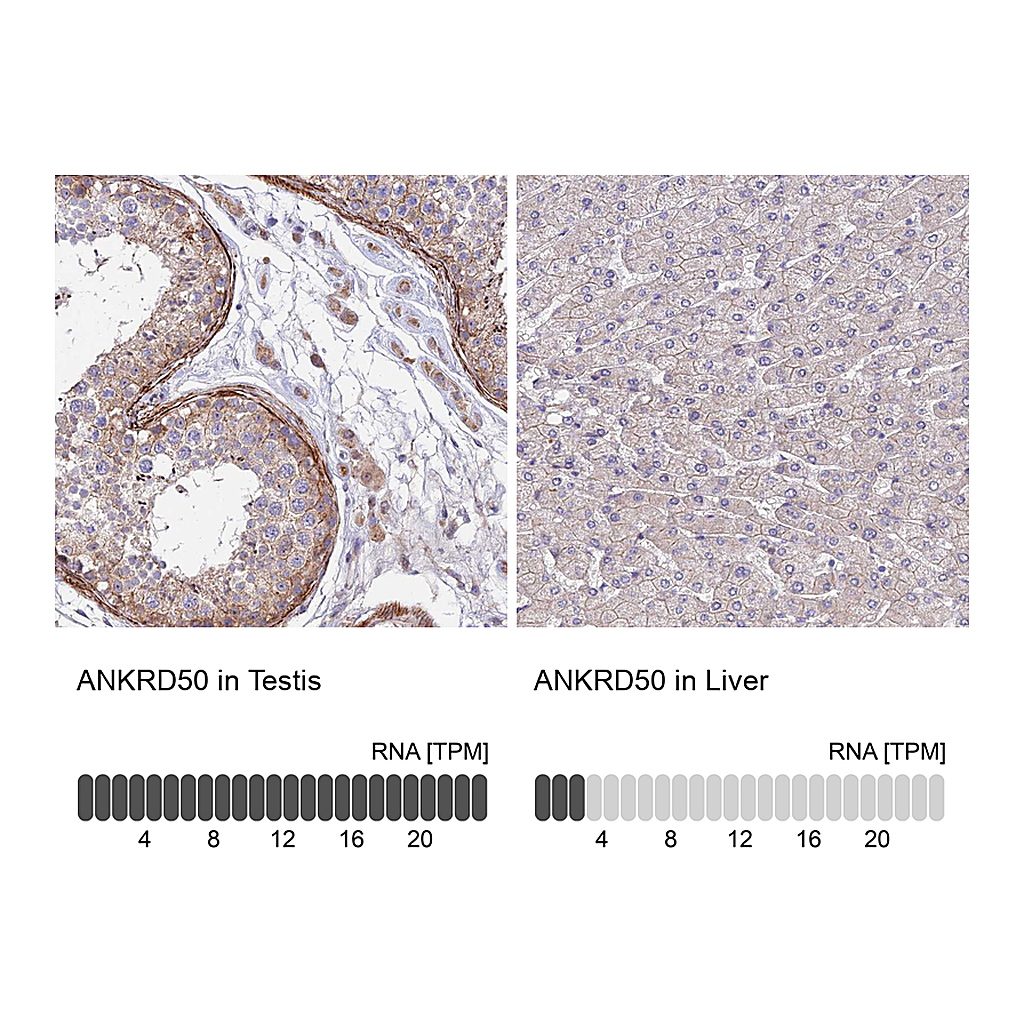 Atlas Antibodies Anti-ANKRD50 Antibody