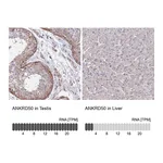 Atlas Antibodies Anti-ANKRD50 Antibody