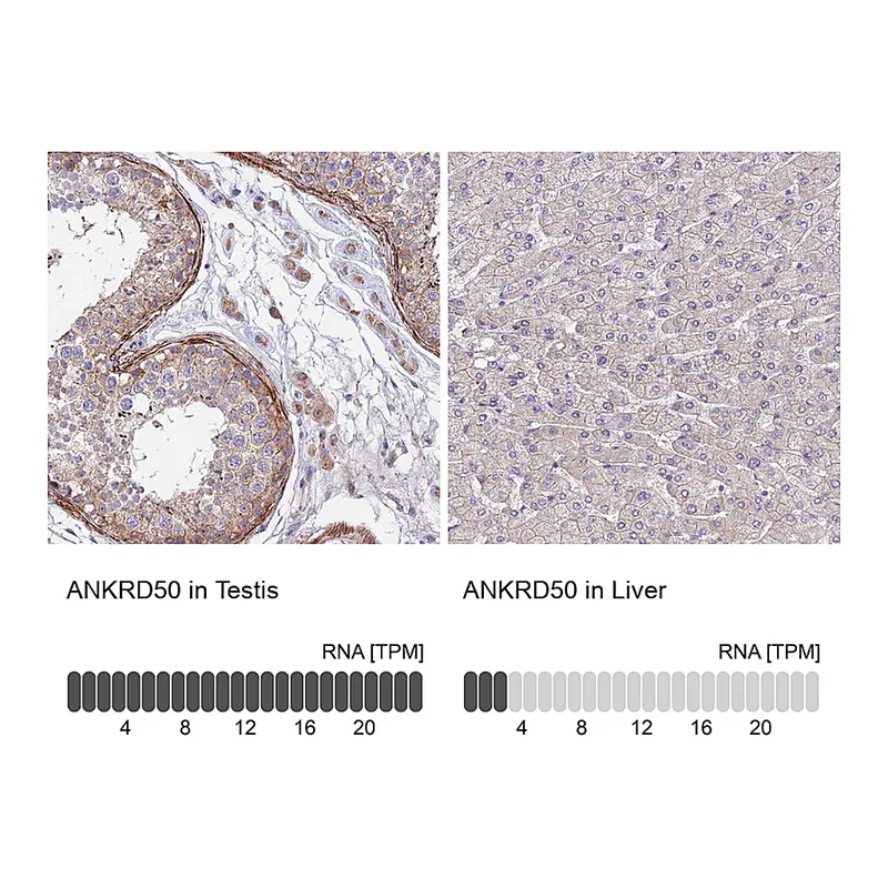 Atlas Antibodies Anti-ANKRD50 Antibody