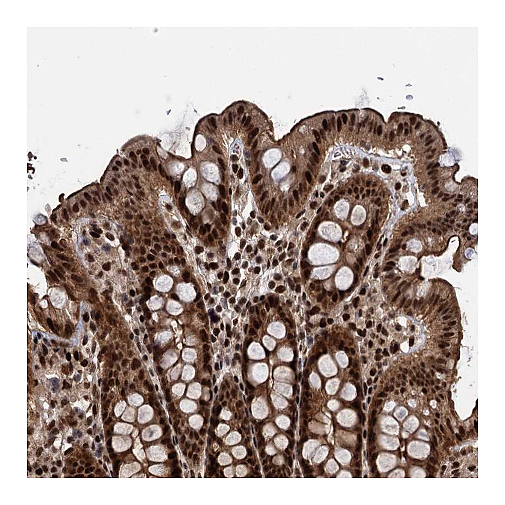 Atlas Antibodies Anti-ANKRD49 Antibody