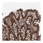 Atlas Antibodies Anti-ANKRD49 Antibody