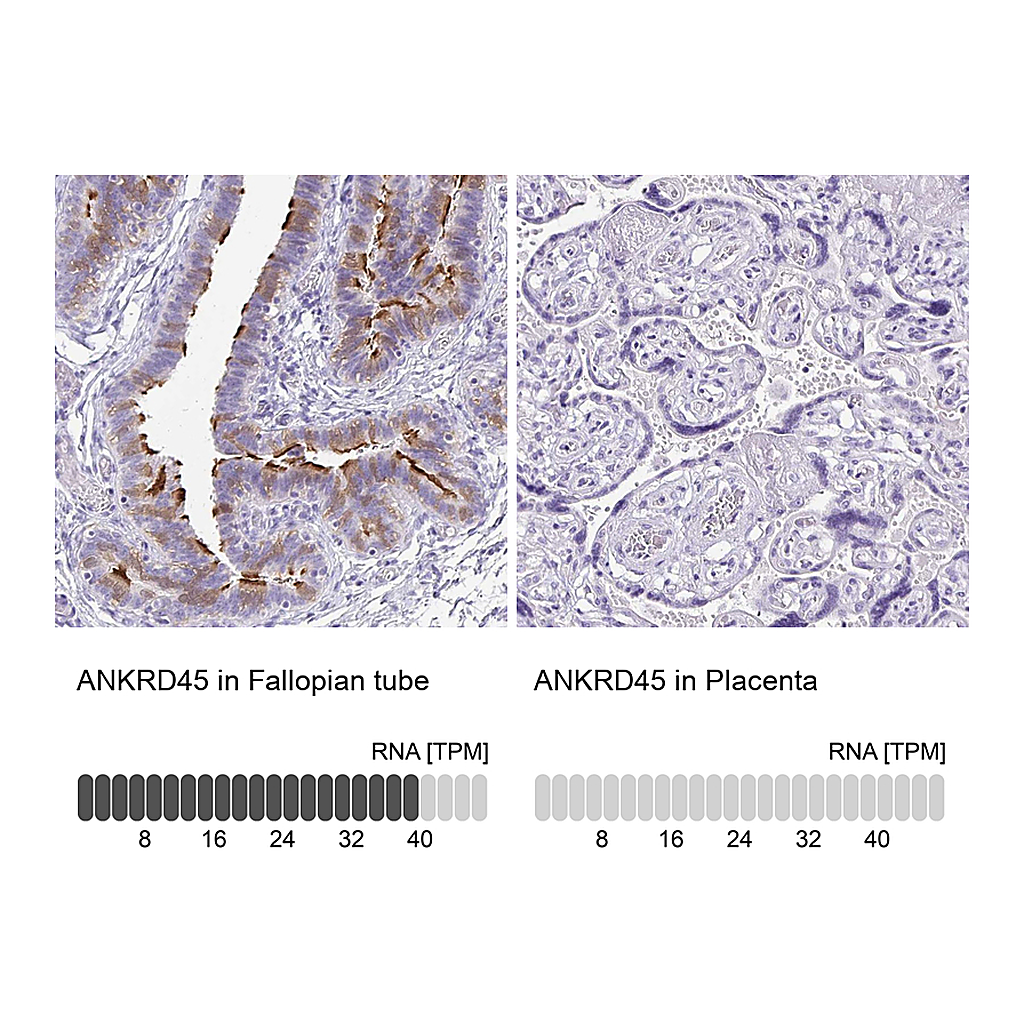 Atlas Antibodies Anti-ANKRD45 Antibody
