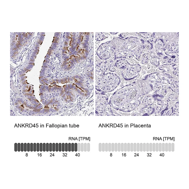 Atlas Antibodies Anti-ANKRD45 Antibody