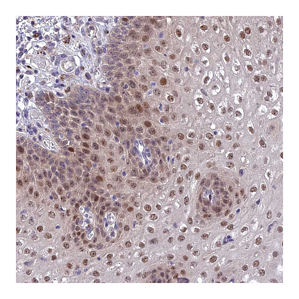 Atlas Antibodies Anti-ANKRD52 Antibody