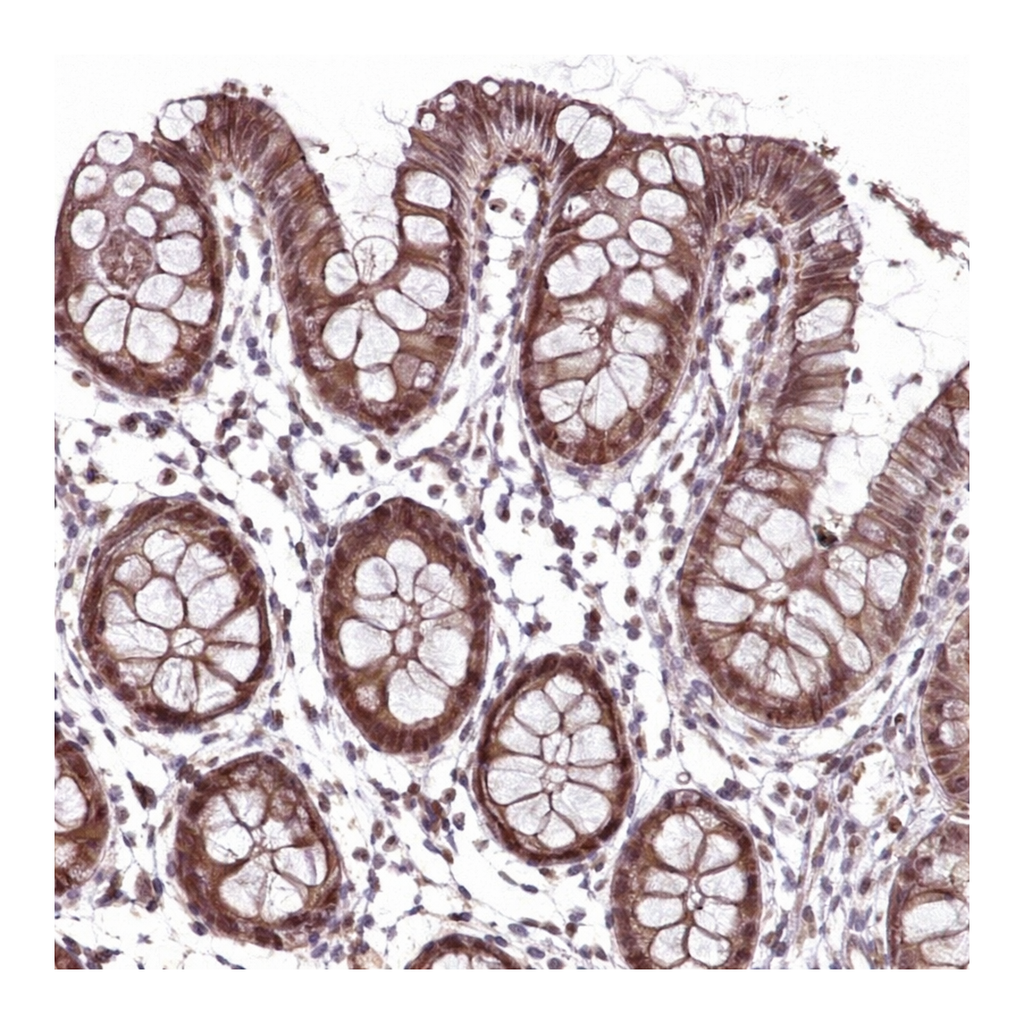 Atlas Antibodies Anti-ANKRD54 Antibody