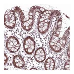Atlas Antibodies Anti-ANKRD54 Antibody