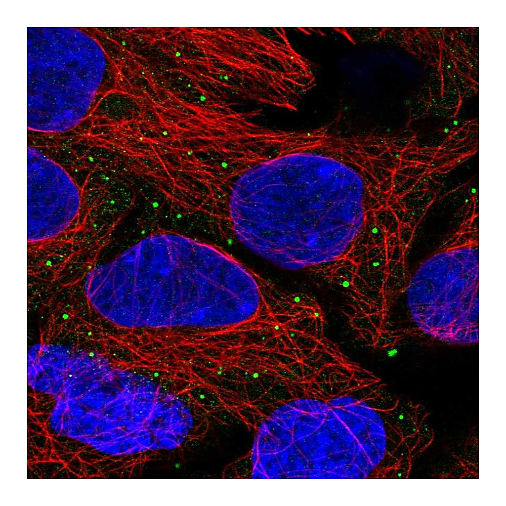 Atlas Antibodies Anti-ANKRD6 Antibody
