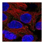Atlas Antibodies Anti-ANKRD6 Antibody