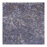 Atlas Antibodies Anti-ANKRD55 Antibody