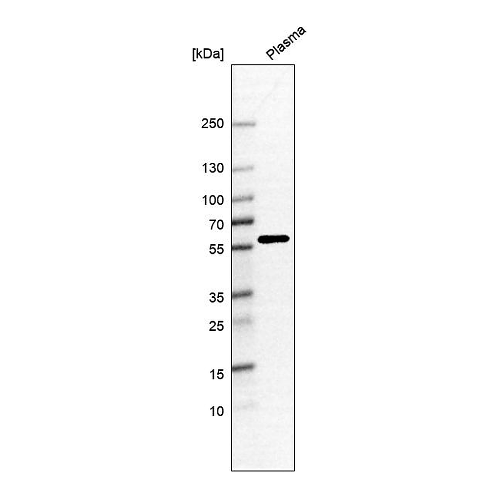 Atlas Antibodies Anti-ANKRD55 Antibody