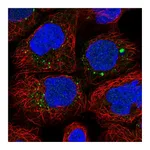 Atlas Antibodies Anti-ANKRD6 Antibody