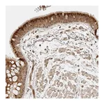 Atlas Antibodies Anti-ANKRD61 Antibody