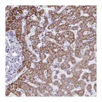 Atlas Antibodies Anti-ANKRD60 Antibody