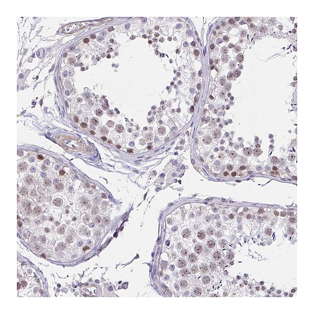 Atlas Antibodies Anti-ANKRD62 Antibody