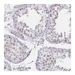 Atlas Antibodies Anti-ANKRD62 Antibody