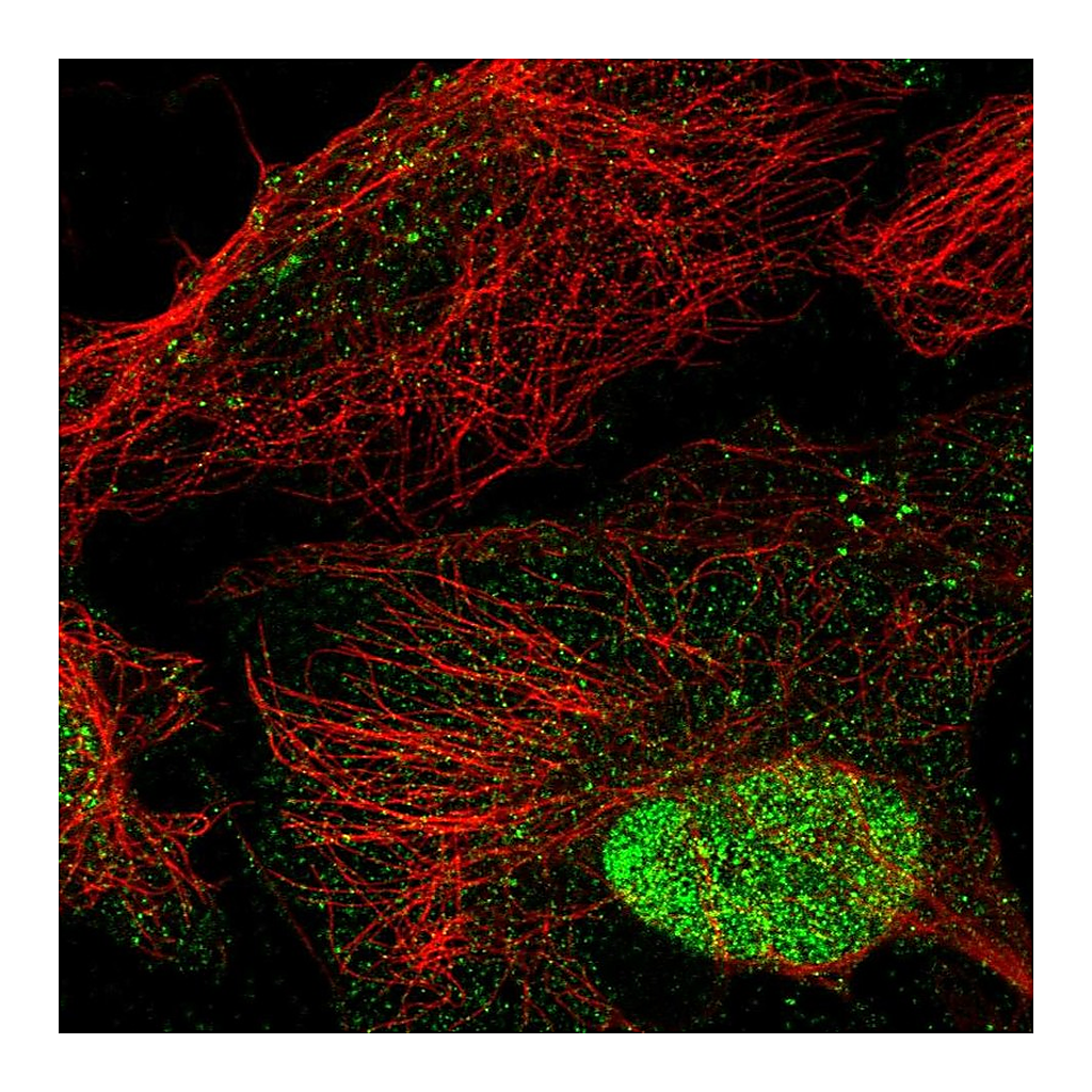 Atlas Antibodies Anti-ANKRD7 Antibody
