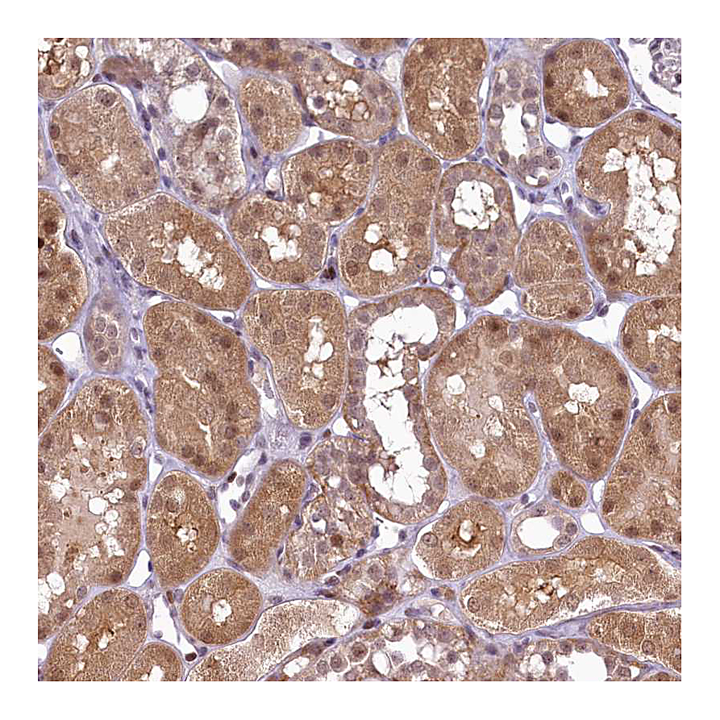 Atlas Antibodies Anti-ANKS3 Antibody