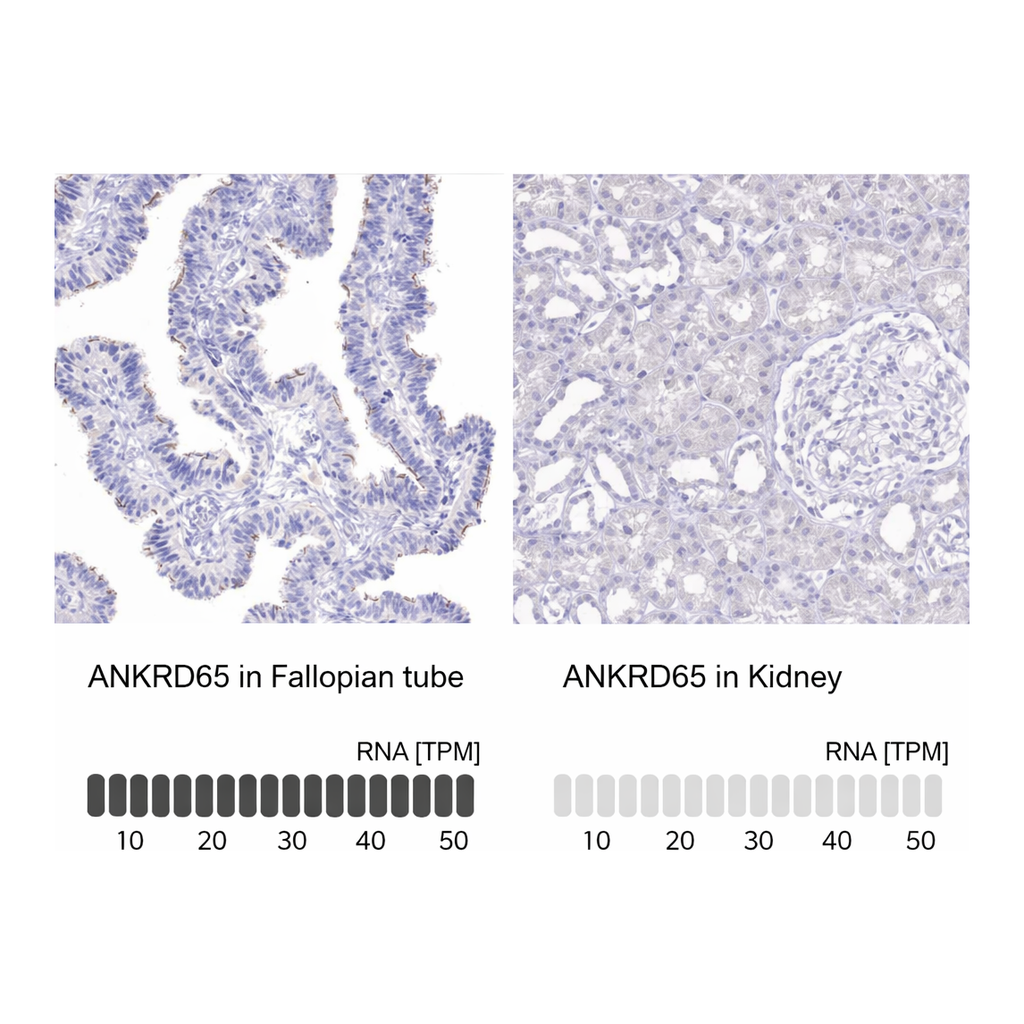 Atlas Antibodies Anti-ANKRD65 Antibody