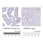Atlas Antibodies Anti-ANKRD65 Antibody
