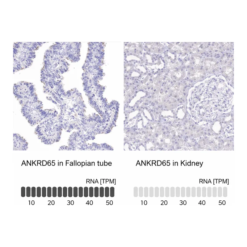 Atlas Antibodies Anti-ANKRD65 Antibody