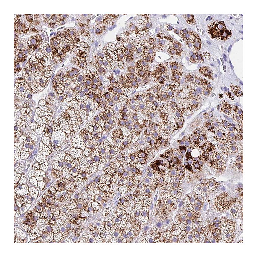Atlas Antibodies Anti-ANKRD9 Antibody
