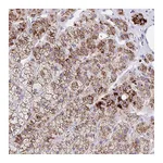 Atlas Antibodies Anti-ANKRD9 Antibody