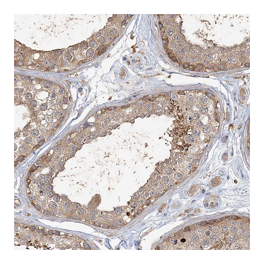 Atlas Antibodies Anti-ANKS1A Antibody
