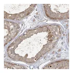 Atlas Antibodies Anti-ANKS1A Antibody