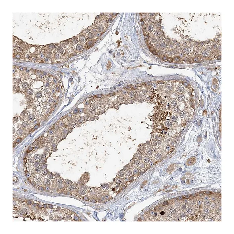 Atlas Antibodies Anti-ANKS1A Antibody